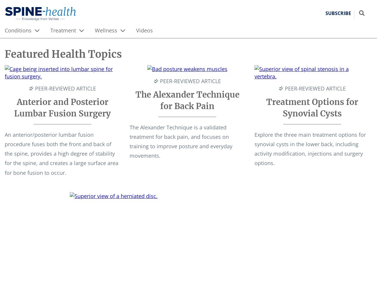 Spine health.com ca59793a0dea02cfb2c585b581e90cd2